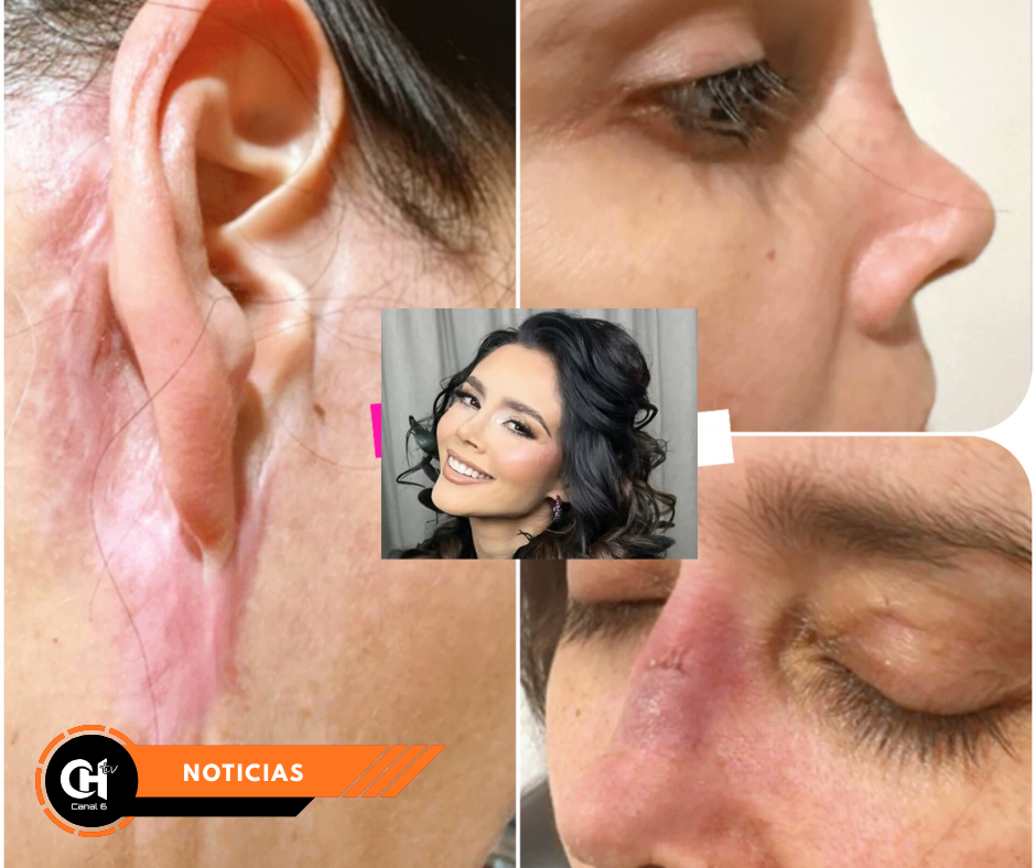 Dorismar reaparece y genera impacto por cambio en su rostro tras cirugía estética